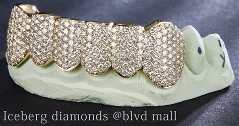 grillz las vegas|Gold and Diamond Mouth Grillz in Las Vegas, NV